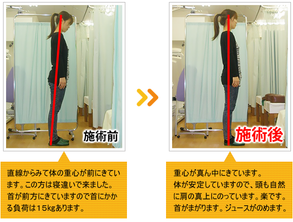 ビフォーアフター