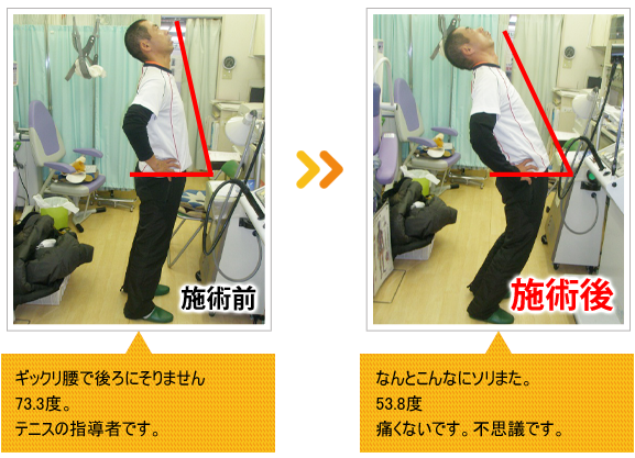 ビフォーアフター