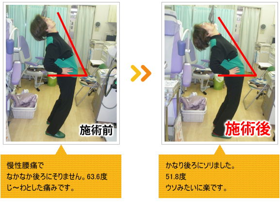 ビフォーアフター