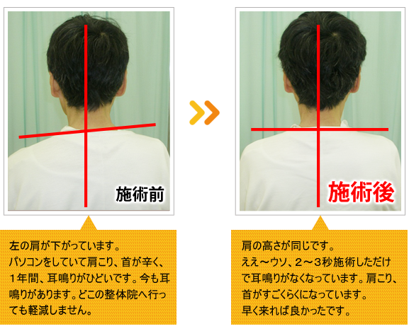 ビフォーアフター