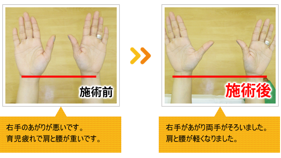 ビフォーアフター