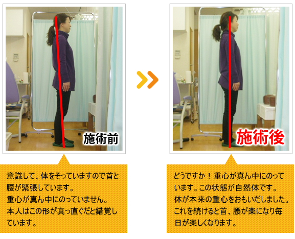 ビフォーアフター