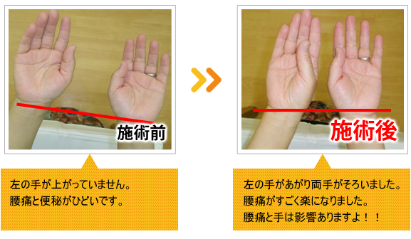 ビフォーアフター