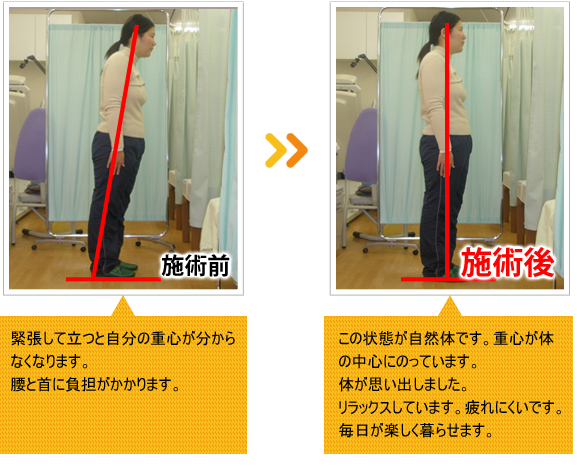 ビフォーアフター
