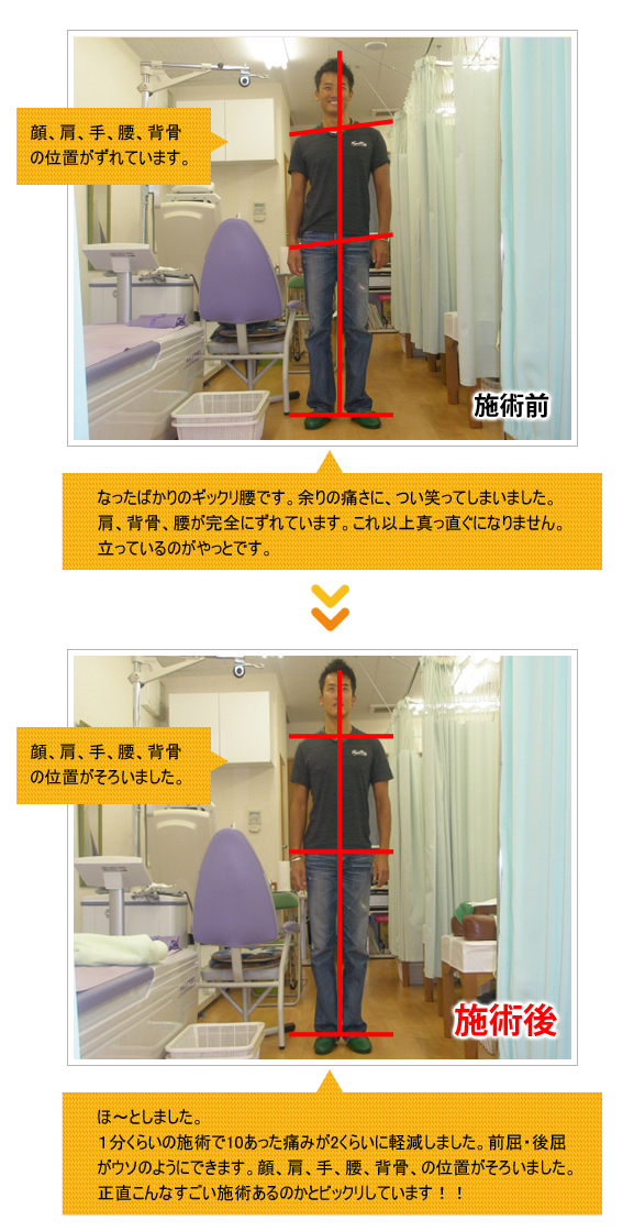 ビフォーアフター