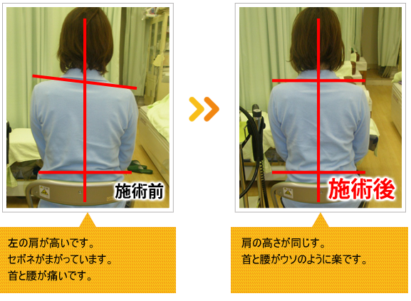 ビフォーアフター