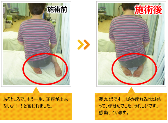 ビフォーアフター