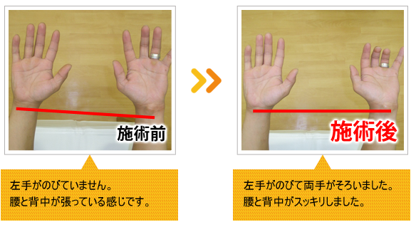 ビフォーアフター