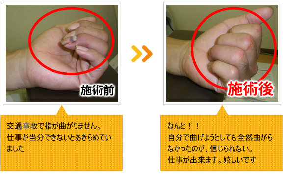 ビフォーアフター