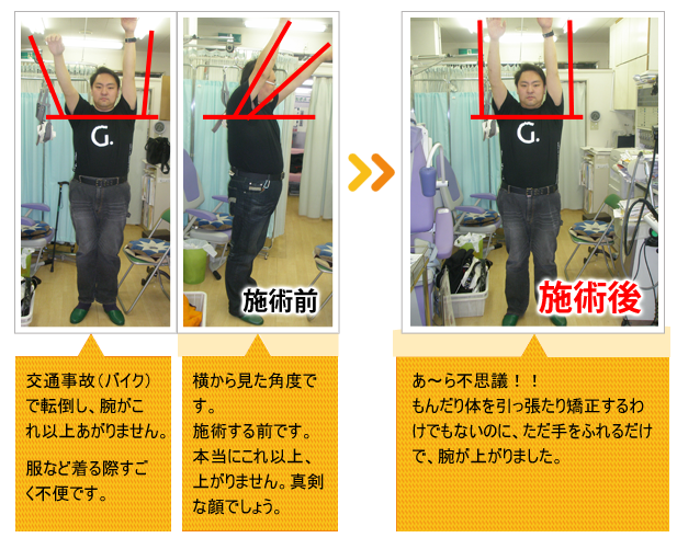 ビフォーアフター
